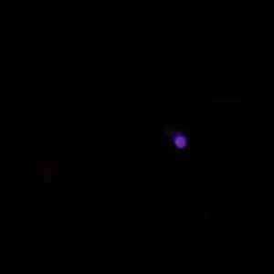 just a dull spec: Kirlian photography of