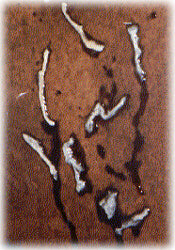 intestinal worms killed by orgone clark zapper - terminator zapper Worms killed by the parasite zapper aka clark zapper aka orgone zapper aka terminator zapper
